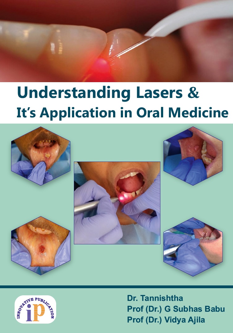 Understanding Lasers and it's Application in Oral Medicine